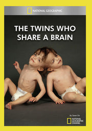 the twins who share a brain - DVD