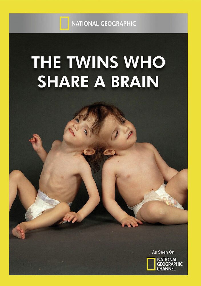 the twins who share a brain - DVD