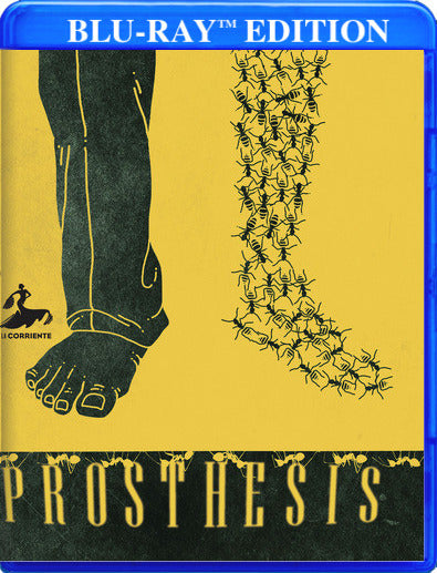 Prosthesis - 