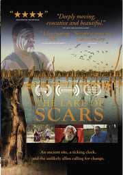 the lake of scars - DVD