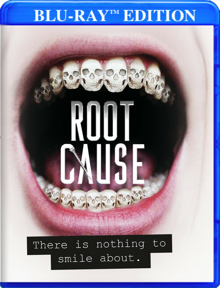 Root Cause - 