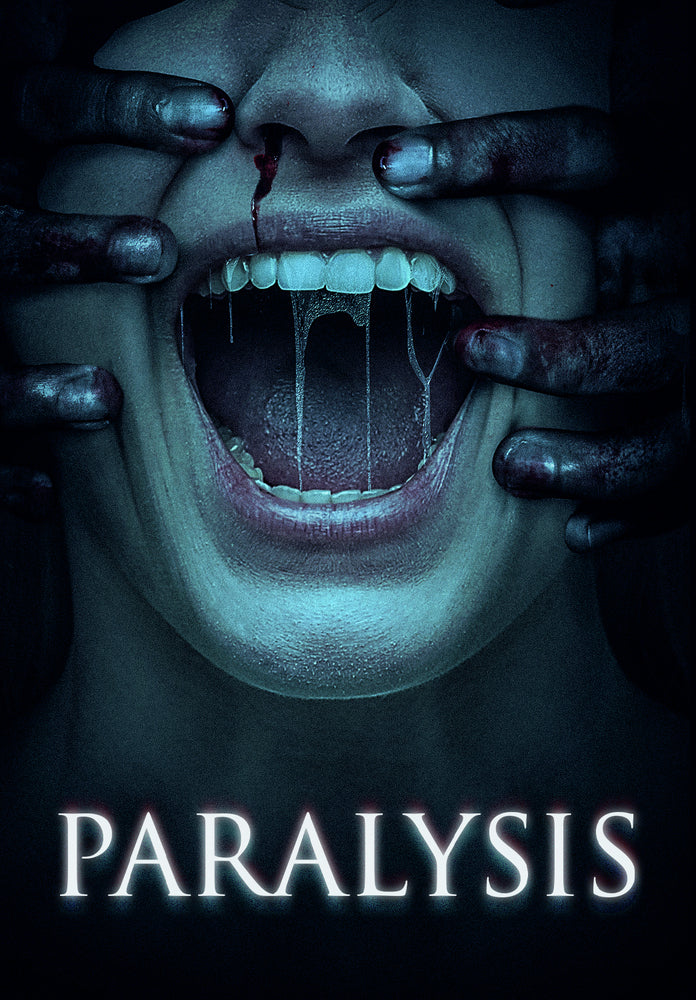 Paralysis - 