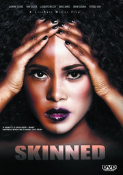 Skinned - 