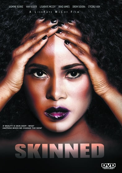 Skinned - 